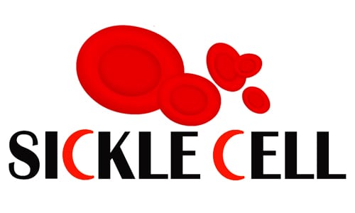 sicklecell